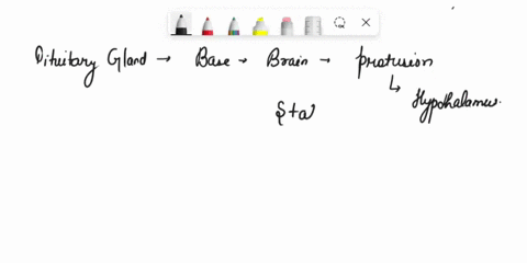 list-the-four-types-of-general-sensory-receptors-and-iden-tify-the-nature-of-the-stimulus-that-excites-each-type-46795