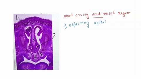 match-the-label-number-on-the-left-with-the-structure-name-on-the-right-this-is-frontal-section-throu-oral-cavity-and-nasal-regions-paraseptal-cartilage-nasal-septum-olfactory-epithelium-vom-42956