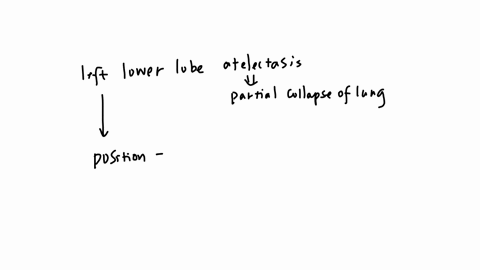 a-nurse-is-caring-for-a-client-who-has-left-lower-lobe-atelectasis-in-which-of-the-following-positions-should-the-nurse-place-the-client-for-postural-drainage-a-side-lying-with-the-right-side-of-the-c