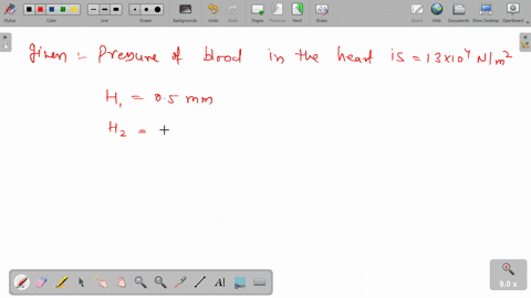 calculate-the-pressure-of-the-blood-in-the-brain-and-in-the-feet-of-a-pearson-when-standing-the-average-pressure-of-the-blood-in-the-heart-is-13104nm2-above-atmospheric-pressure-the-brain-is-58673