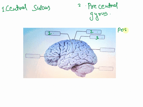 ssearch-anyting-answers-reque-1-the-slaqel-onto-the-diagram-identify-the-structures-lateral-sulcus-ceniral-sulcus-postcentral-gyrus-2-precentral-gyrus-fissure-transverse-cerebral-sulcus-pari-94388