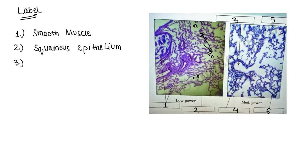 solved-label-the-following-lung-simple-squamous-bpnhbling-hshooogy