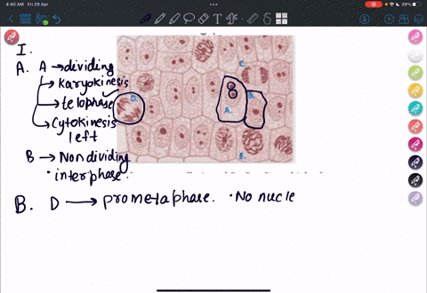 describe-the-differences-between-cells-and-b-predict-which-phase-of-the-cell-cycle-the-cells-are-in_-explain-your-rationale-which-of-the-following-cells-isare-in-metaphase-which-of-the-cells-76008
