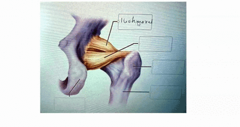 correctly-label-the-following-anatomical-features-of-the-coxal-joint-ransvelse-ecetabular-iigameni-pubolemoral-ligament-femur-ischlal-luberosily-gieater-trochantet-round-gament-otenoral-iduu-87547