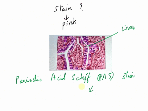 refer-t0-the-image-below-what-staln-was-used-t0-generate-the-pink-cells-shown-in-the-image-below-94128