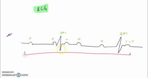 in-order-to-produce-the-heart-rate-in-panel-c-of-the-figure-showing-ecg-traces-the-_____-division-of-the-autonomic-nervous-system-would-have-to-be-activated-31754
