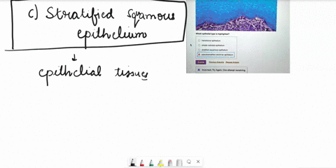 Transitional Vs Simple Columnar 5 20 epithelial tissue histology which epithelial type is highlighted ...