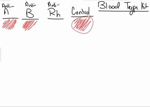 brrelle-ceeey-wards-shared-materials-4-unkown-simulated-blood-samples-1mrsmith-2msjones-3mrgreen-4msbrown-anti-a-simulated-typing-serum-anti-b-simulated-typing-serum-anti-rh-simulated-typing-96107