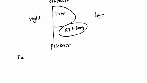 sagittal-plane-patient-supine-label-the-orientation-of-the-ultrasound-screen-the-liver-is-to-the-right-kidney-draw-an-arrow-to-the-inferior-pole-of-the-right-kidney-draw-a-triangle-posterior-00087