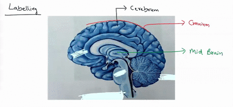 11-label-the-diagram-with-thc-following-terms-cerebellum-arbor-vitae-brainstem-cerebra-aqueduct-cerebnum-corpus-callosum-fornix-fourth-ventricle-hypothalamus-thalamus-mammillary-body-medulla-18118