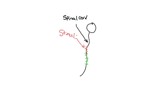 the-flexor-withdrawal-reflex-is-an-intersegmental-reflex-because-it-a-involves-reciprocal-innervation-b-is-a-contralateral-reflex-c-can-occur-in-any-region-of-the-spinal-cord-ddoes-not-invol-62794