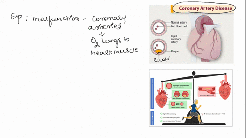 what-are-three-basic-physiological-alterations-resulting-from-exercise-training-that-would-reduce-the-risk-of-death-from-coronary-artery-disease-90011