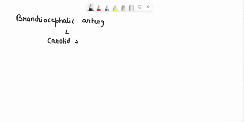 istion-the-first-branch-the-aortic-arch-the-brachiocephalic-artery-which-divides-into-the-left-common-corotid-artery-and-the-left-subckvion-arttry-rue-false-45819