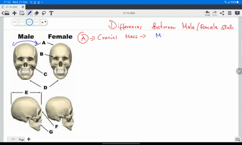 incorrect-question-8-0-2-pts-features-of-the-skull-that-can-help-determine-the-sex-of-a-skeletonized-person-include-the-following-except-occipital-bun-mastoid-process-shape-of-eye-sockets-br-81232