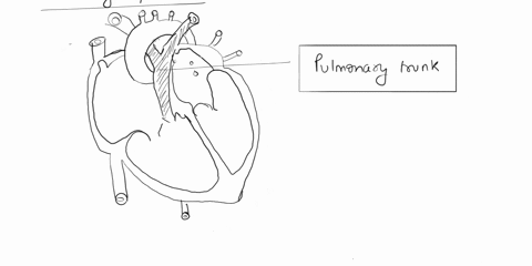 which-structure-is-highlighted-and-indicated-by-the-leader-line-multiple-choice-aorta-superior-vena-cava-pulmonary-trunk-coronary-sinus-pulmonary-vein-34132