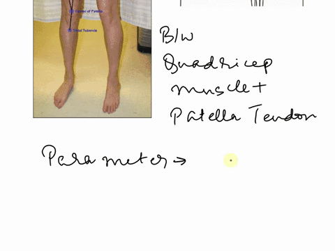 estimate-your-own-q-angle-using-a-marker-draw-a-dot-on-your-anterior-superior-iliac-spine-of-the-pelvis-the-midpoint-of-the-patella-and-your-tibial-tuberosity-stand-with-your-knees-extended-45025