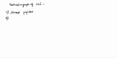 describe-4-functions-of-the-skin-2-describe-the-location-structure-and-function-of-the-dermis-and-hypodermis-3-list-4-kinds-of-epidermal-cells-and-their-contribution-to-the-functions-of-skin-37543