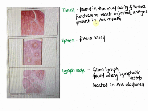 match-the-following-statements-with-the-appropriate-tissue-sample-filters-lymph-found-in-the-oral-cavity-and-throat-spleen-tonsil-found-along-lymphatic-vessels-lymph-node-located-in-the-abdo-76805
