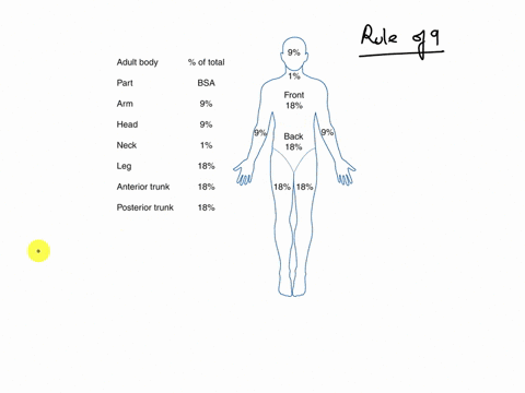 using-the-rule-of-nines-please-calculate-the-percentage-of-body-that-was-burned-a-patient-comes-in-with-2nd-degree-burns-on-their-right-anterior-arm-anterior-left-forearm-entire-anterior-tru-68633