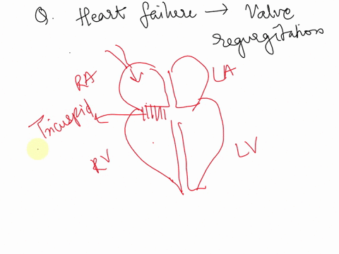 5-in-josies-case-congestive-heart-failure-was-caused-by-a-stenotic-bicuspid-valve-however-other-valve-abnormalities-can-also-cause-heart-failure-define-valve-regurgitation-and-explain-how-it-46994