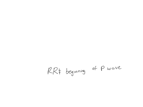 when-reading-a-ecg-the-pr-interval-should-not-be-longer-than-how-many-milliseconds-a-200-b-500-c-300-d-100