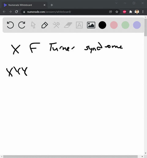 sex-chromosome-disorders-chromosoma-gender-makeup-mor-f-name-of-disorder-characteristics-xyy-xxy-xxx-71002