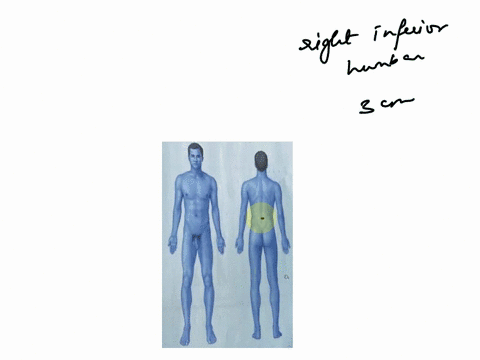 oure11-figure-not-in-anatomical-position-lane-2-locate-the-following-woundsand-mark-them-on-the-body-in-figure-119-the-wound-is-located-in-the-right-inferior-lumbar-region-it-is-3-cm-lateral-26365