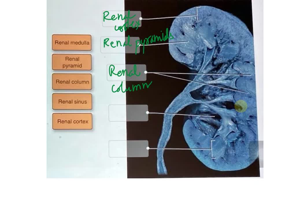 SOLVED: Label the external anatomy of the kidney using the hints ...