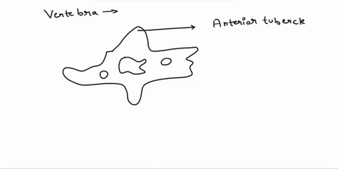 label-the-structures-of-the-vertebra-vertebral-foramen-transverse-process-anterior-tubercle-lateral-mass-atlas-posterior-tubercle-58444