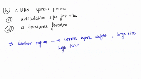 a-typical-lumbar-vertebra-has-______-a-a-short-rounded-spinous-process-b-a-bifid-spinous-process-c-a-11183
