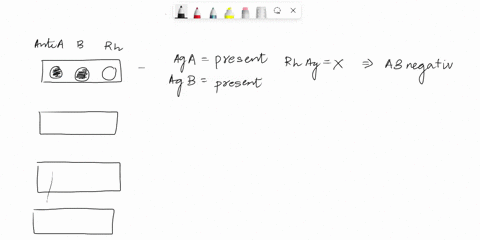 interpreting-blood-typing-results-complete-this-exercise-in-each-example-below-determine-the-blood-type-by-studying-the-agglutination-pattern-and-answering-the-antigen-questionsclumps-of-rbc-30096