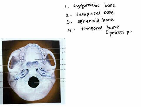 bone-bone2-8-ma-10-id-process-11-terms-foramenmagnum-tncisive-foramen-maxilla-occipitat-bone-occipitat-condyle-palatine-bone-palatine-process-of-maxilla-sphenoid-bone-temporal-bone-vomer-bon-75211