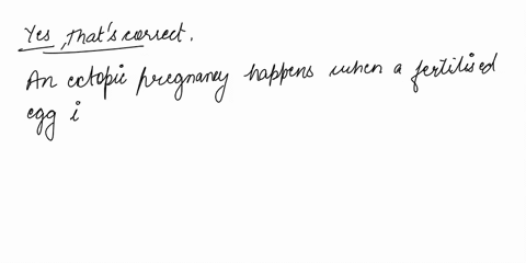 exencisestney-lab-sectior-the-female-reproductive-system-date-an-ectopic-pregnancy-occurs-when-the-early-embryo-implants-at-a-location-outside-the-uterus-a-common-site-for-an-cctopic-uterine-06403