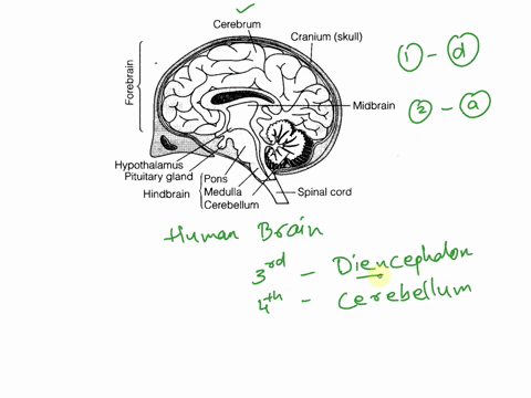 21-which-ofthe-following-surrounds-the-two-laeencerharocles-diencephalon-d-cerebrum-telencephalon-brin-stem-cerebellum-surrounds-the-44-ventricle-surrounds-the-3-ventricle-brain-stem-cerebel-48726