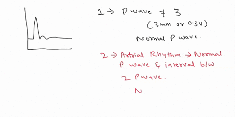 step-evaluate-the-p-waves-step-evaluate-the-atrial-rhythm-step-3-determine-atrial-rate-calculate-the-duration-of-the-pr-step-4-interval-step-evaluate-the-ventricular-rhythm-step-6-determine-50128