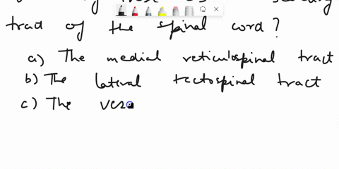 question2-which-of-these-is-an-ascending-tract-of-the-spinal-cord-oathe-medial-reticulospinal-tract-obthe-lateral-tectospinal-tract-cthe-vestibulospinal-tract-odthe-ventral-corticospinal-tra-74866