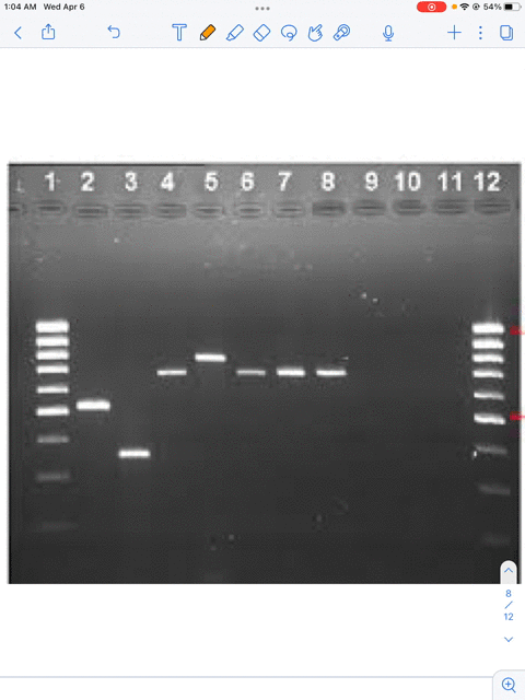 you-ran-an-experiment-in-lab-that-produced-the-following-gel-electrophoresis-results-which-wells-were-negative-control-and-did-not-contain-any-7-2-3-4-5-6-7-400-bp-300-bp-dna-fragments-selec-18206