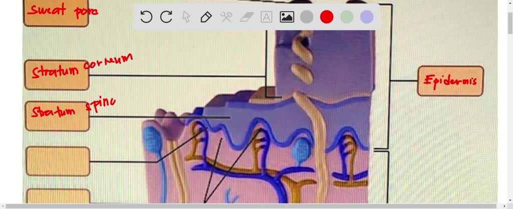 Solved: Ch 05 Integumentary System Assignment Item 1 1 Of 14 Review 