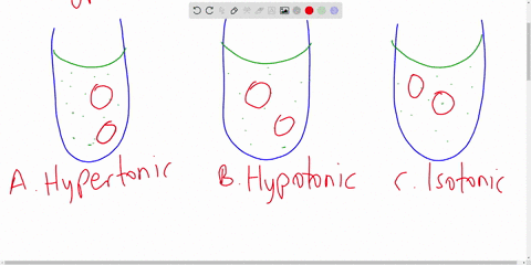 for-the-following-question-1-select-the-correct-answer-and-2-explain-why-your-answer-is-correct-a-hyperosmotic-solution-is-a-hypertonic-b-hypotonic-c-isotonic-d-not-enough-information-to-det-55763
