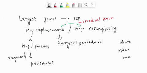 the-nurse-cares-for-the-client-having-a-left-total-hip-arthroplasty-in-which-position-does-the-nurse-place-the-client-after-surgery-61287