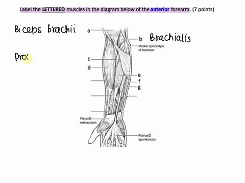 b-medial-epicondyle-of-humerus-c-d-e-g-flexor-retinaculun-palmar-aponeurosis-15567