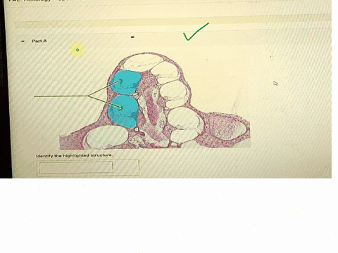 nervous-system-ans-and-special-senses-laboratory-palhistologyspecial-senseslab-practicalquestion5-parta-identify-the-highlighted-structure-34668