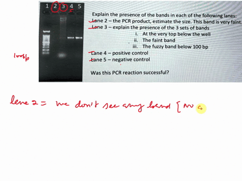 examine-the-gel-image-below-in-this-image-pcr-of-specific-target-was-done-template-in-lane-1-is-using-genomic-dna-as-100-bp-ladder-in-lanes-and-3-are-the-pcr-reactions-dna-lanes-4-and-5-are-32378