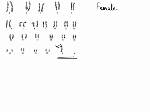 a-male-b-female-2-what-is-abnormal-about-this-karyotype-a-missing-a-sex-chromosome-b-two-extra-pairs-of-autosomal-chromosomes-c-both-a-and-b-3-what-is-the-name-of-this-chromosomal-disorder-a-41425