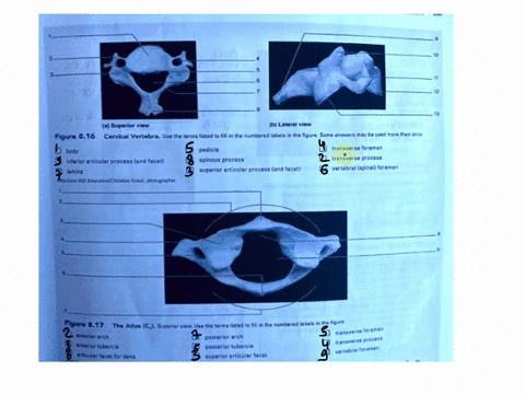 81-chapter-elght-the-steletal-syematial-slelton185-0-asuperior-view-b-lateral-view-figure-816-cervical-vertebra-use-the-terms-listed-to-fill-in-the-numbered-labels-in-the-figure-some-answers-85996