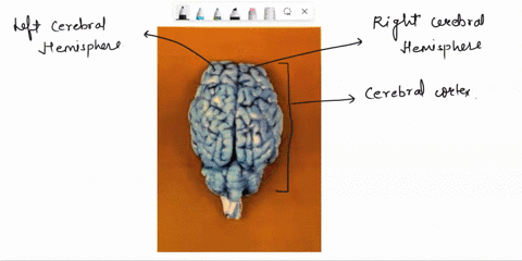 please-label_the_following-structures-on_the-pictures-for-the-superior-view-of-the-brain-label-the-cerebrum-cerebral-hemispheres-left-and-right-gyri-and-sulci-cerebral-cortex-the-frontal-lob-08733