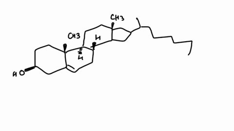 13-which-of-the-following-statements-about-cholesterol-is-not-correct-cholesterol-a-ldls-low-density-lipoproteins-transport-cholesterol-from-the-liver-t0-tissues-ard-cells-6-hdls-high-densit-99396
