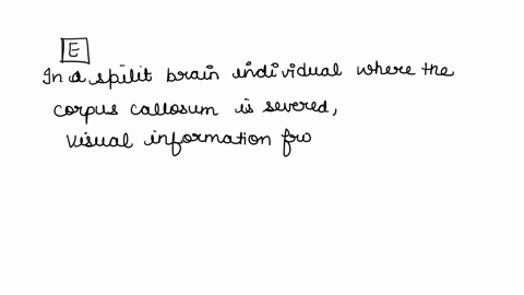 if-a-picture-of-an-object-is-projected-onto-the-left-visual-field-of-a-split-brain-individual-who-is-subsequently-asked-to-select-the-object-by-touch-from-an-array-of-objects-without-viewing-60201