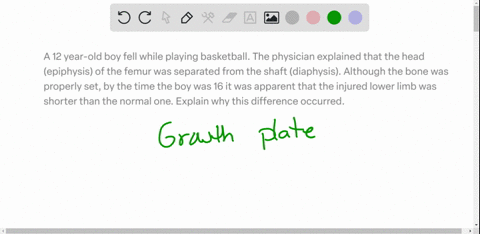 a-12-year-old-boy-fell-while-playing-basketball-the-physician-explained-that-the-head-epiphysis-of-the-femur-was-separated-from-the-shaft-diaphysis-although-the-bone-was-properly-set-by-the-73284