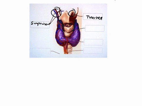 correctly-label-the-following-gross-anatomy-of-the-gland-correctly-label-the-following-gross-anatomy-of-the-this-gland-isthmus-inferior-thyroid-vein-thyroid-gland-cricoid-cartilage-trachea-p-23234